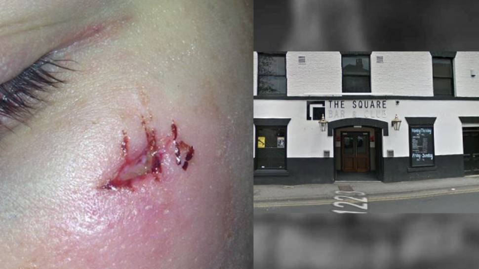 Police appeal for information following assault at Selby nightspot.